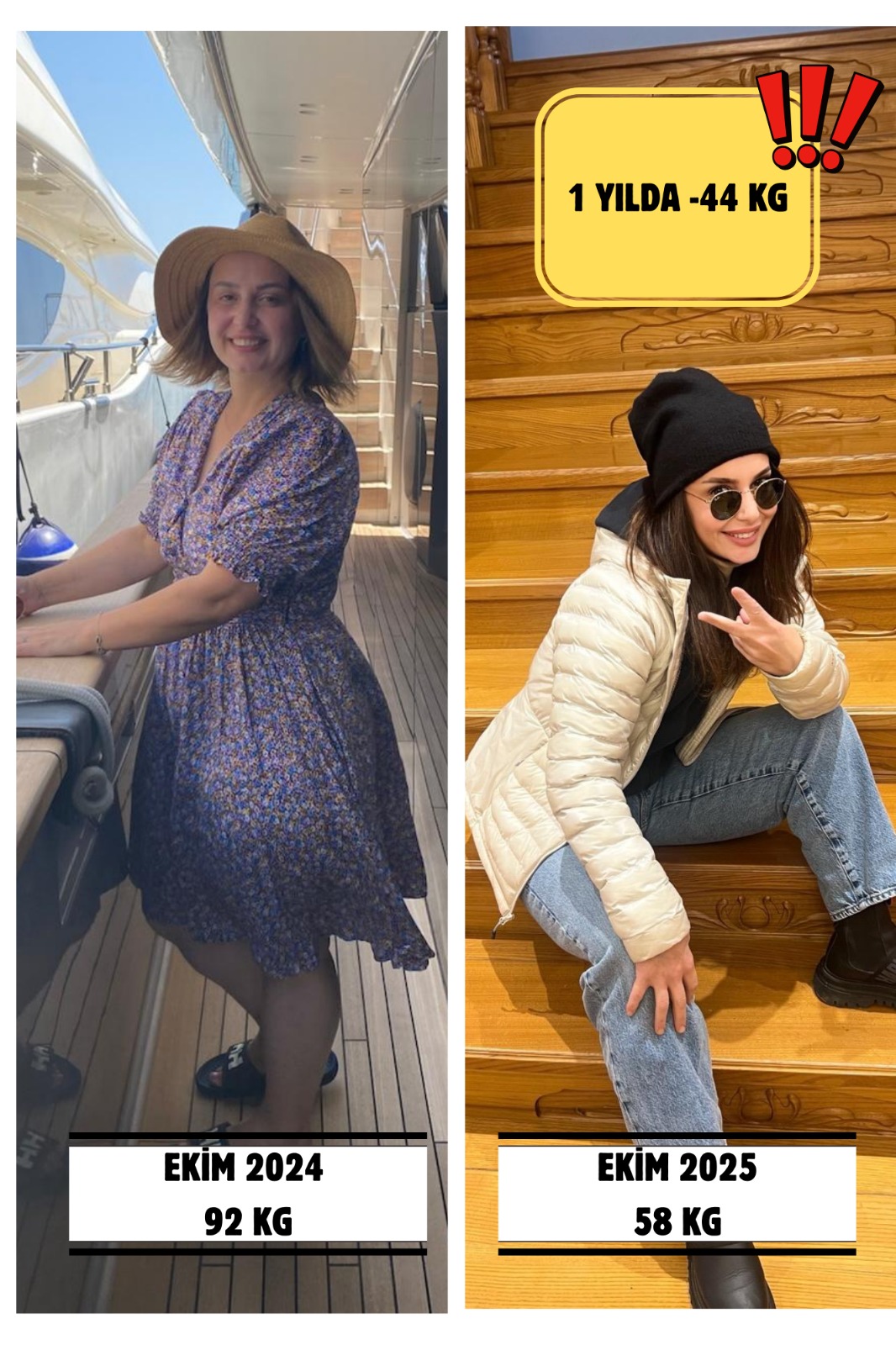 Metabolik Cerrahi öncesi ve sonrası